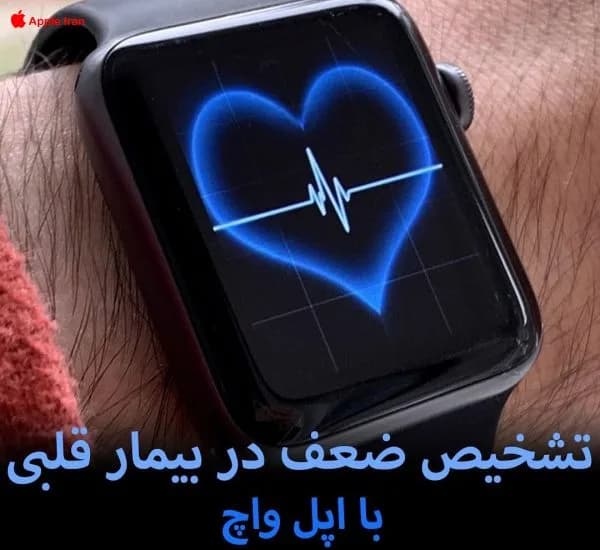 تشخیص ضعف در بیمار قلبی با اپل واچ